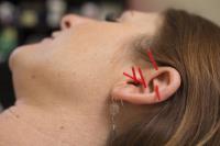 Groundswell Acupuncture image 4